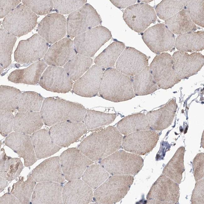 DRAK2 Antibody in Immunohistochemistry (Paraffin) (IHC (P))