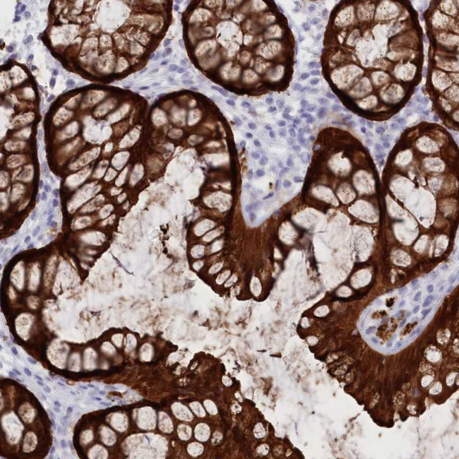 CK1 gamma-2 Antibody in Immunohistochemistry (Paraffin) (IHC (P))