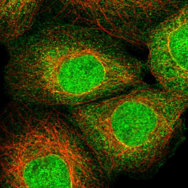 ZNF213 Antibody in Immunocytochemistry (ICC/IF)