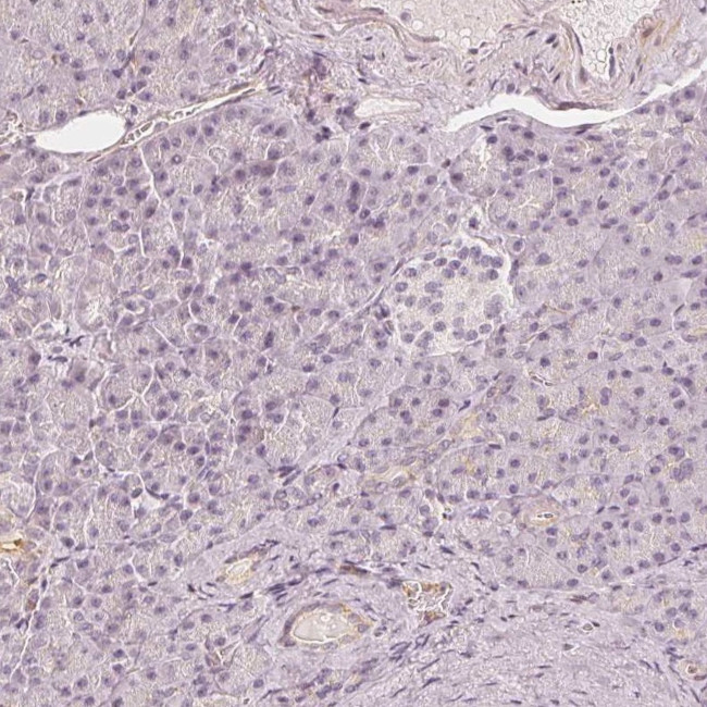 GRAF Antibody in Immunohistochemistry (Paraffin) (IHC (P))