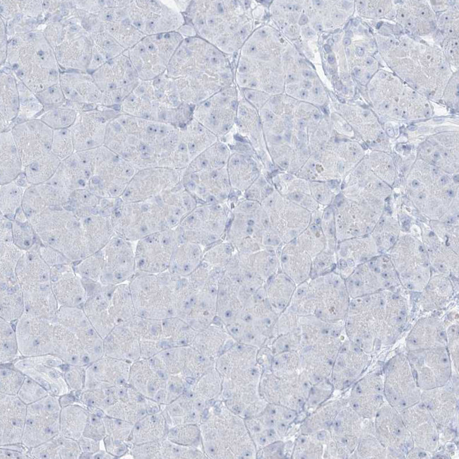 AGXT Antibody in Immunohistochemistry (Paraffin) (IHC (P))