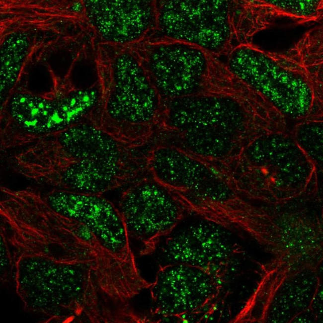 SFMBT2 Antibody in Immunocytochemistry (ICC/IF)