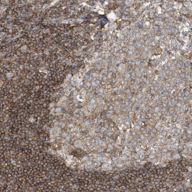 SFMBT2 Antibody in Immunohistochemistry (Paraffin) (IHC (P))