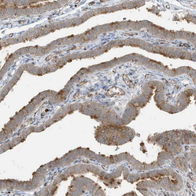 HIPPI Antibody in Immunohistochemistry (Paraffin) (IHC (P))