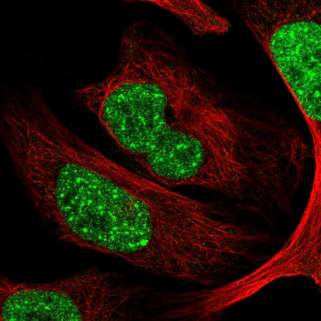CDYL Antibody in Immunocytochemistry (ICC/IF)