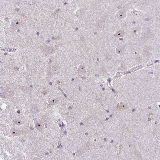 NIFK Antibody in Immunohistochemistry (Paraffin) (IHC (P))