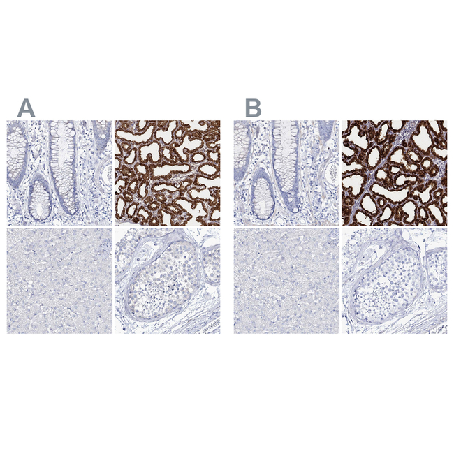 CSN3 (CASK) Antibody in Immunohistochemistry (Paraffin) (IHC (P))