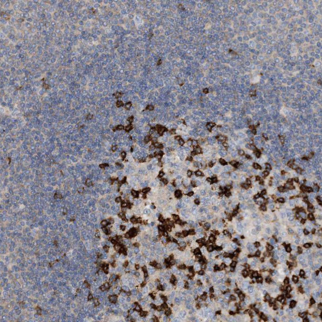 PD-1 Antibody in Immunohistochemistry (Paraffin) (IHC (P))