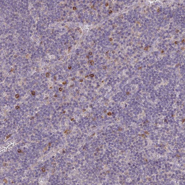 FceR1 alpha Antibody in Immunohistochemistry (Paraffin) (IHC (P))