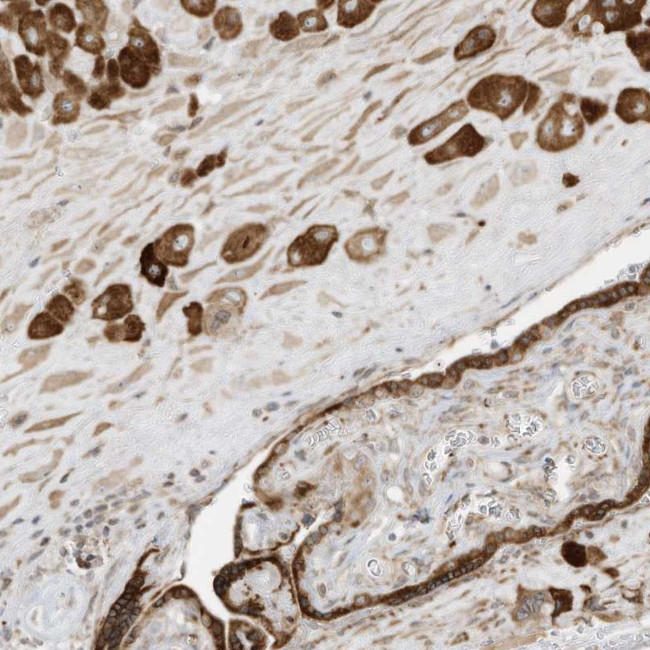 BRK Antibody in Immunohistochemistry (Paraffin) (IHC (P))