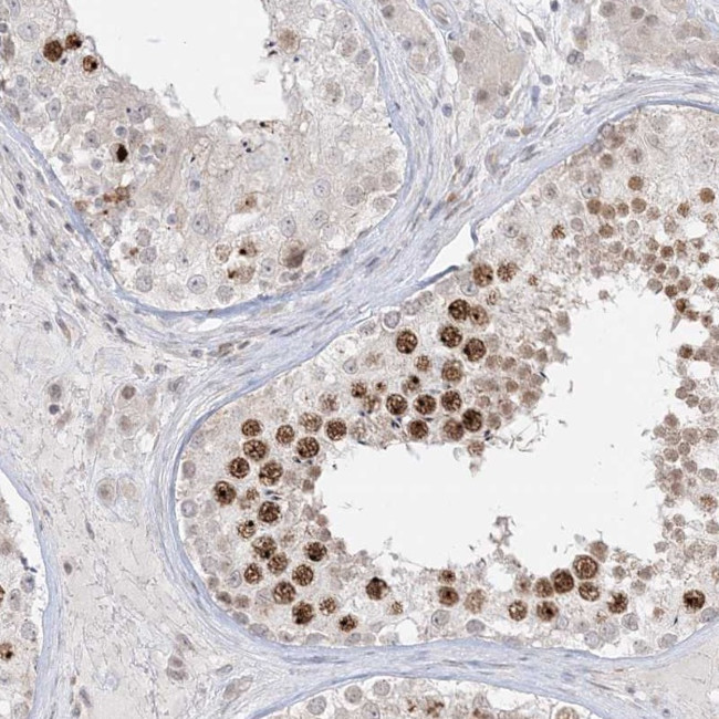 BRK Antibody in Immunohistochemistry (Paraffin) (IHC (P))