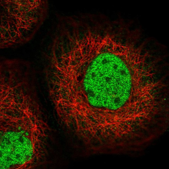 SFMBT1 Antibody in Immunocytochemistry (ICC/IF)