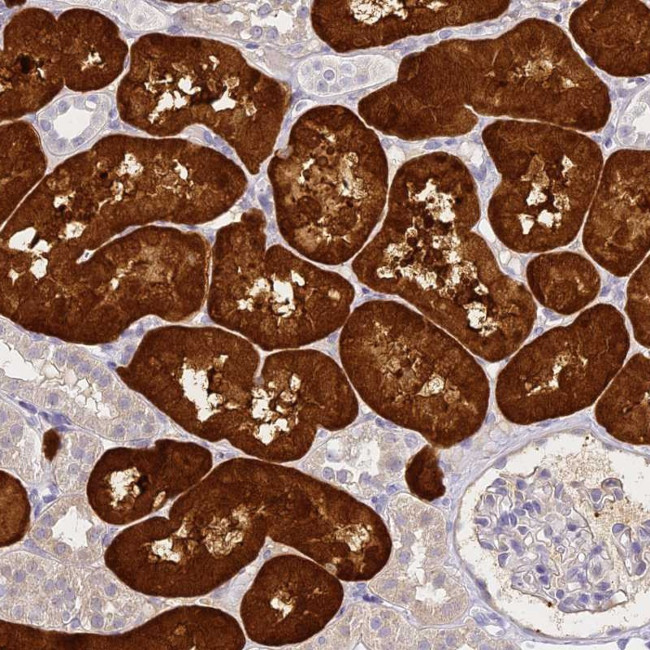 Aminoacylase Antibody in Immunohistochemistry (Paraffin) (IHC (P))
