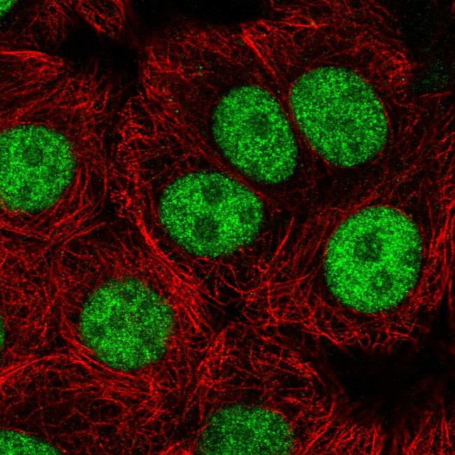USF1 Antibody in Immunocytochemistry (ICC/IF)