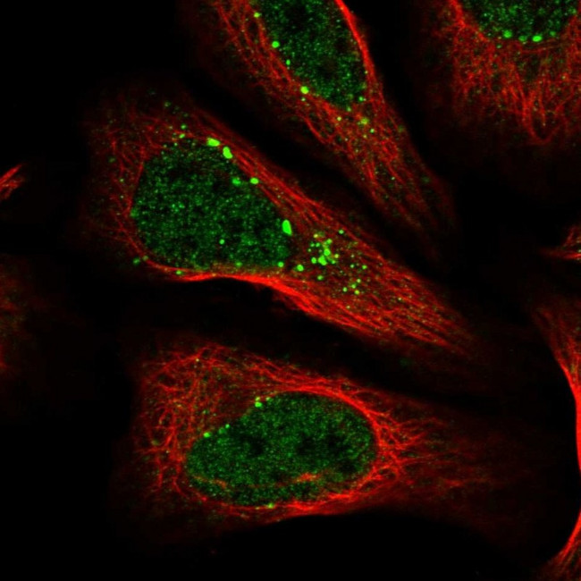SENP8 Antibody in Immunocytochemistry (ICC/IF)