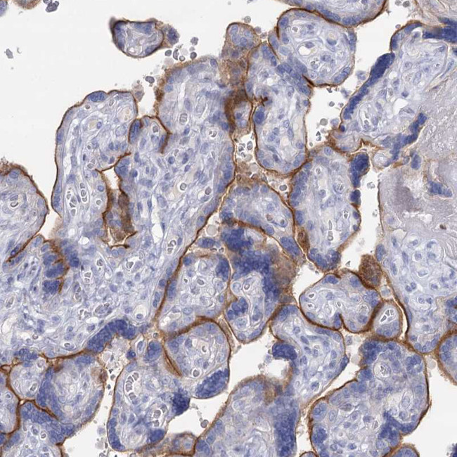 IGSF3 Antibody in Immunohistochemistry (Paraffin) (IHC (P))