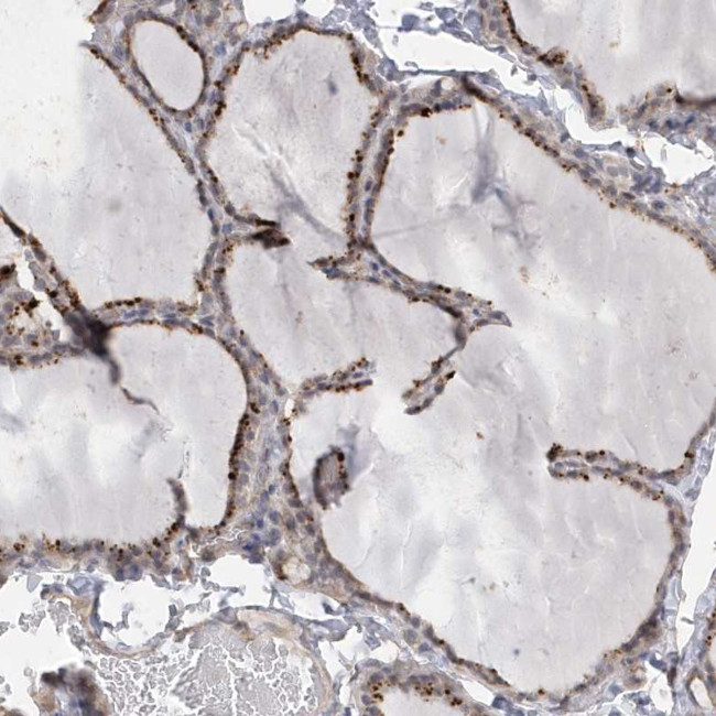APC1 Antibody in Immunohistochemistry (Paraffin) (IHC (P))