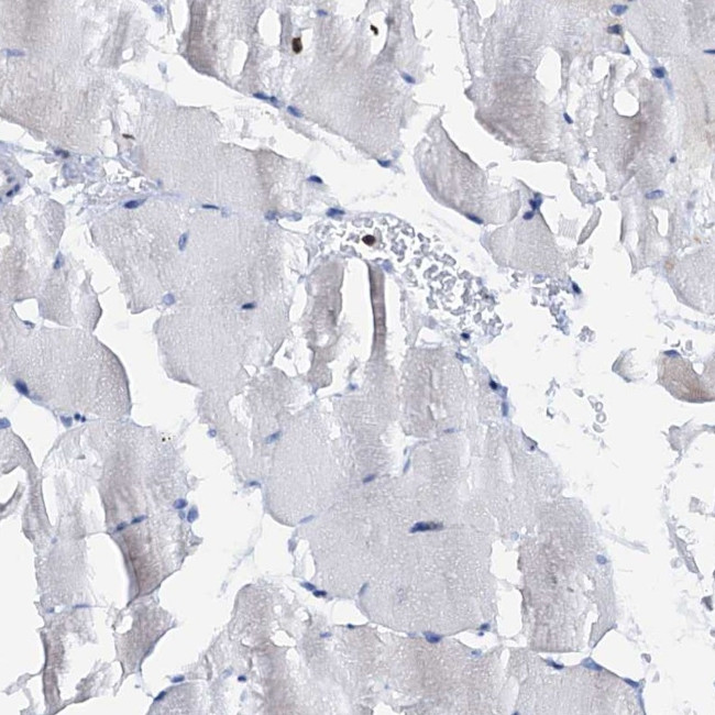 SLP76 Antibody in Immunohistochemistry (Paraffin) (IHC (P))