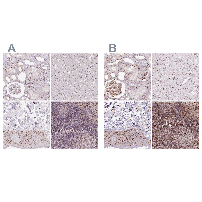 Nucleostemin Antibody in Immunohistochemistry (Paraffin) (IHC (P))