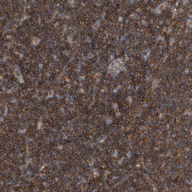 P2Y10 Antibody in Immunohistochemistry (Paraffin) (IHC (P))
