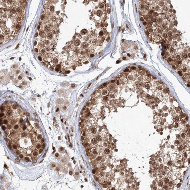 KIF20A Antibody in Immunohistochemistry (Paraffin) (IHC (P))
