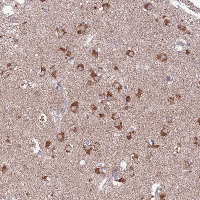 STIM2 Antibody in Immunohistochemistry (Paraffin) (IHC (P))