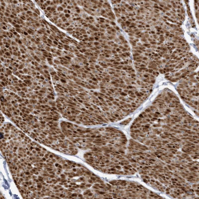 SMC3 Antibody in Immunohistochemistry (Paraffin) (IHC (P))