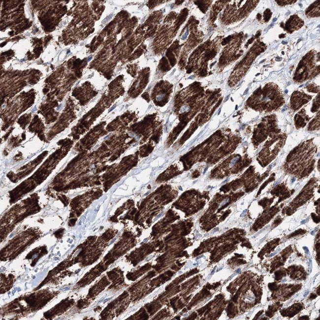 HADHB Antibody in Immunohistochemistry (Paraffin) (IHC (P))