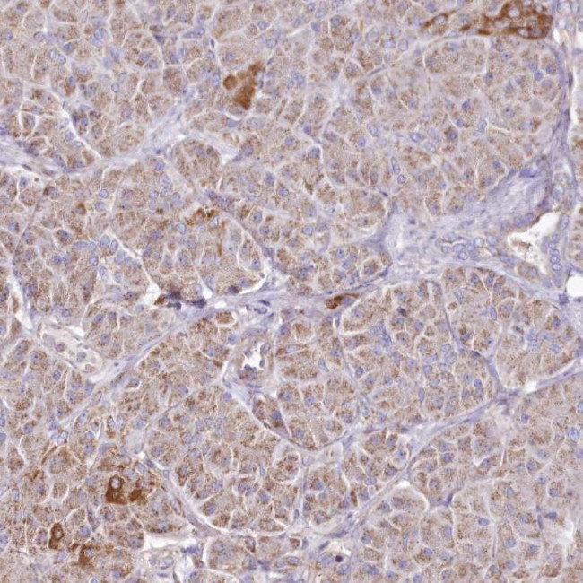 HADHB Antibody in Immunohistochemistry (Paraffin) (IHC (P))