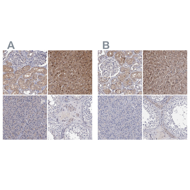GST Omega 1 140A Antibody in Immunohistochemistry (Paraffin) (IHC (P))