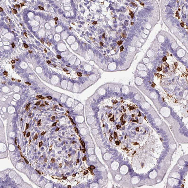 CD8 alpha Antibody in Immunohistochemistry (Paraffin) (IHC (P))