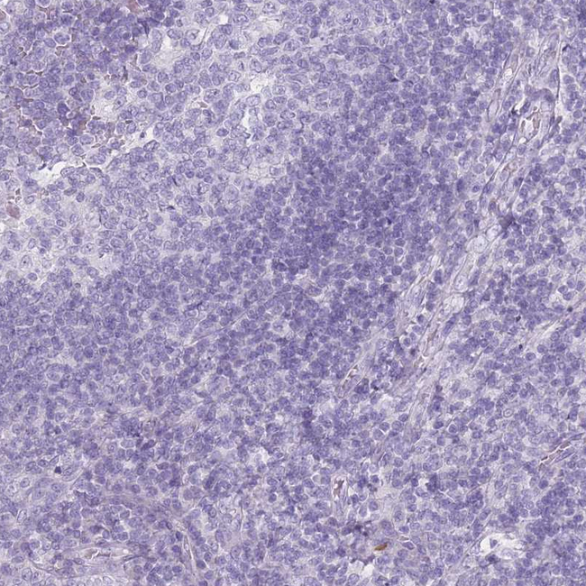 DDX4 Antibody in Immunohistochemistry (Paraffin) (IHC (P))