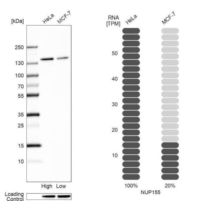 NUP155 Antibody
