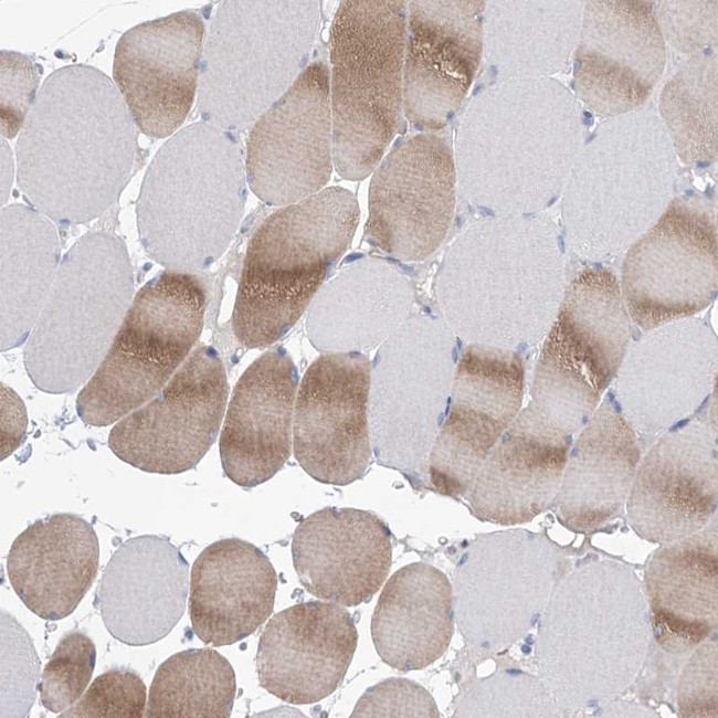 WDR74 Antibody in Immunohistochemistry (Paraffin) (IHC (P))