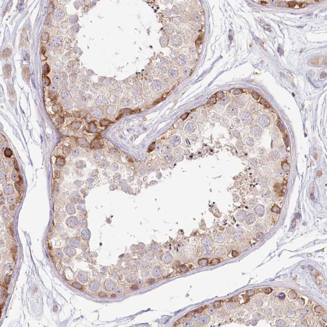 TNIP1 Antibody in Immunohistochemistry (Paraffin) (IHC (P))