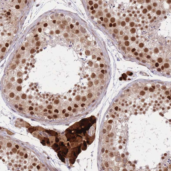XPD Antibody in Immunohistochemistry (Paraffin) (IHC (P))
