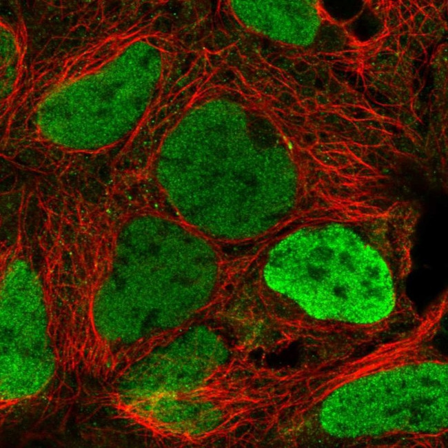 JARID1C Antibody in Immunocytochemistry (ICC/IF)