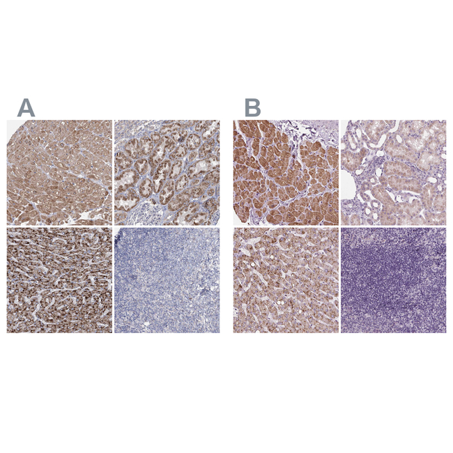 ACOX2 Antibody in Immunohistochemistry (Paraffin) (IHC (P))