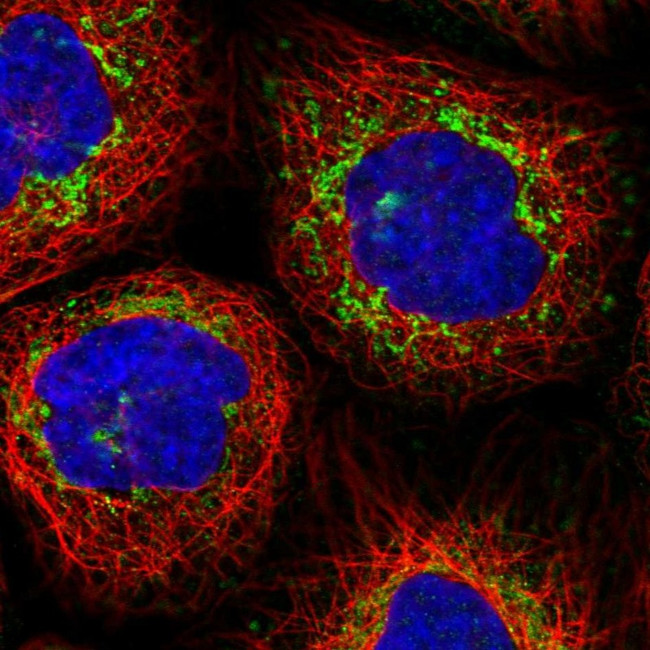 MCCC2 Antibody in Immunocytochemistry (ICC/IF)