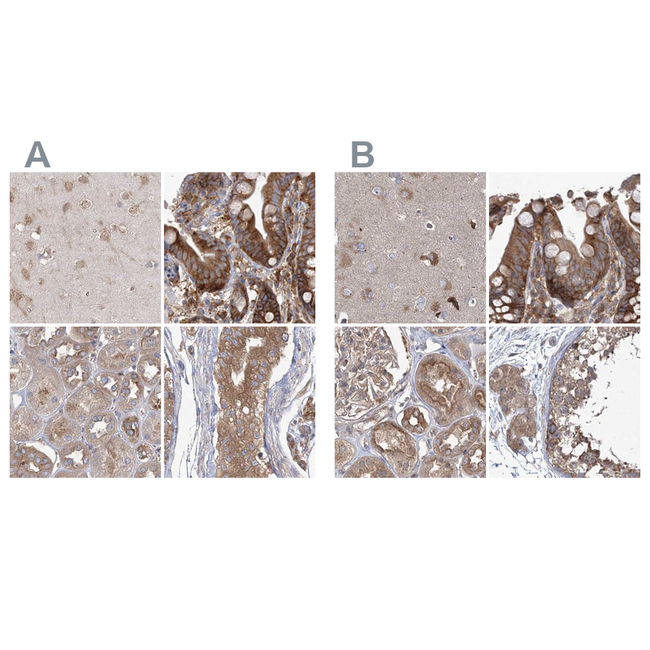 eIF3a Antibody in Immunohistochemistry (Paraffin) (IHC (P))