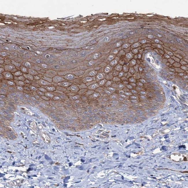 PTPN3 Antibody in Immunohistochemistry (Paraffin) (IHC (P))