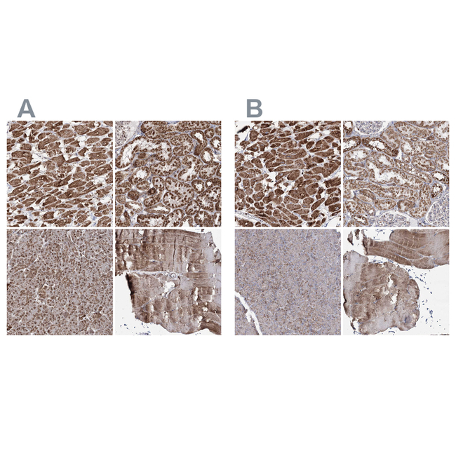 PDHX Antibody in Immunohistochemistry (Paraffin) (IHC (P))