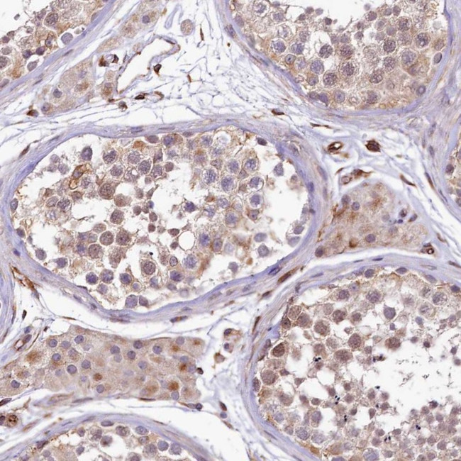 TTC12 Antibody in Immunohistochemistry (Paraffin) (IHC (P))
