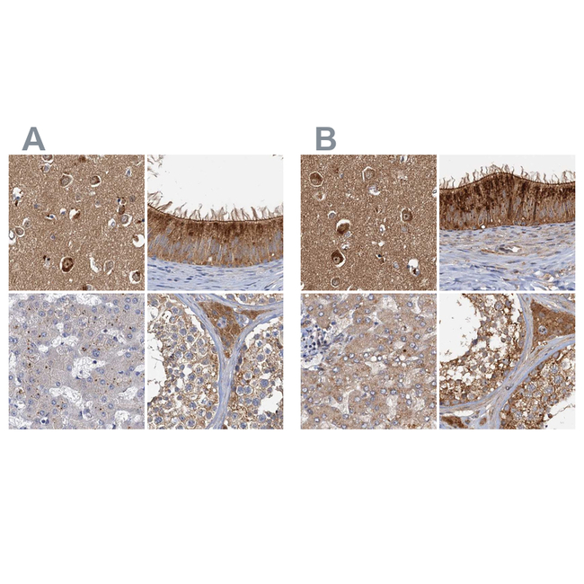 TOLLIP Antibody in Immunohistochemistry (Paraffin) (IHC (P))