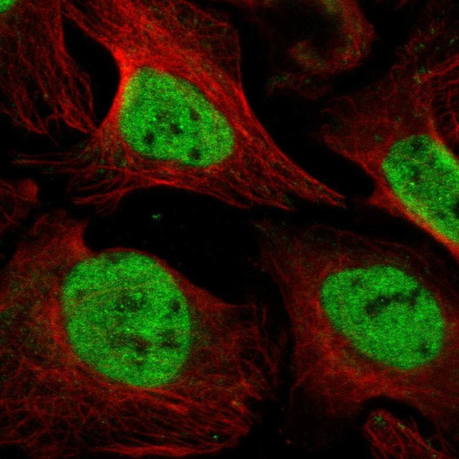 UNC93B1 Antibody in Immunocytochemistry (ICC/IF)