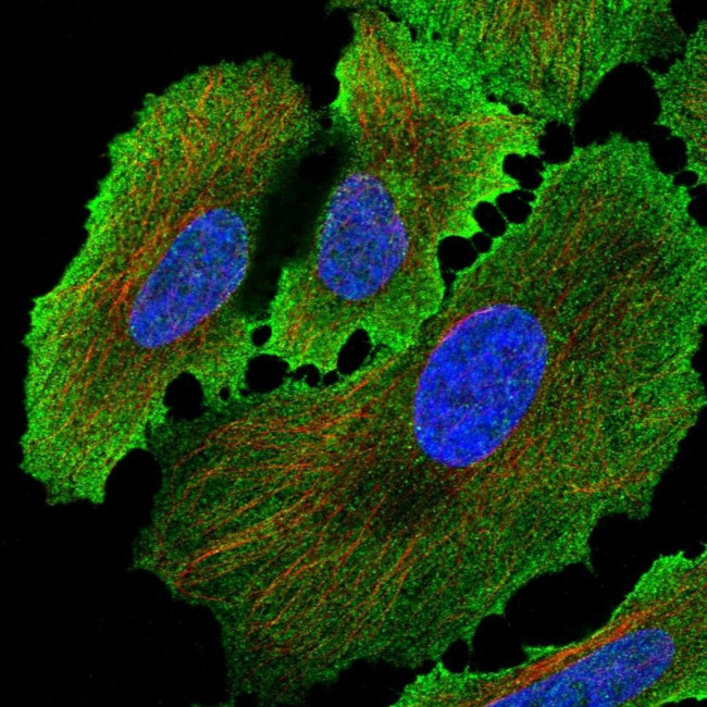 Placental Alkaline Phosphatase Antibody in Immunocytochemistry (ICC/IF)