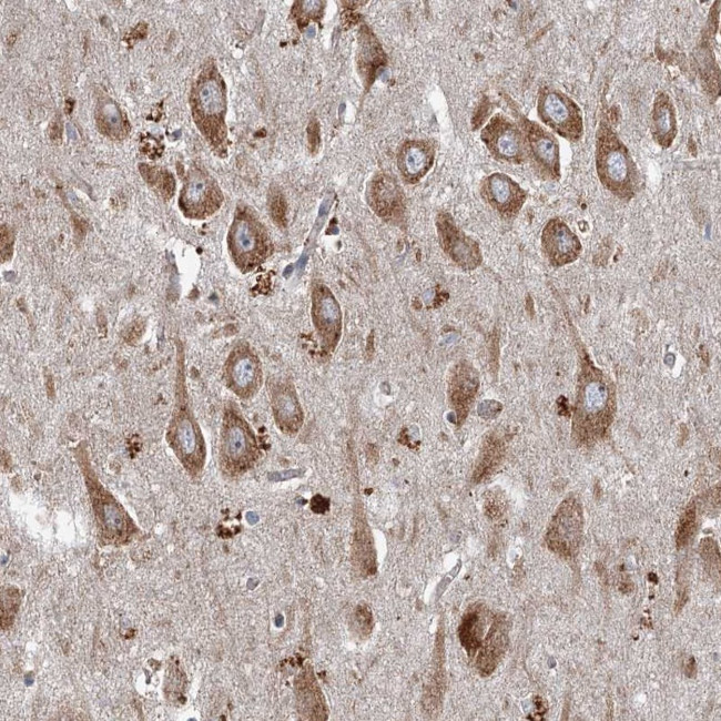 SRPX2 Antibody in Immunohistochemistry (Paraffin) (IHC (P))