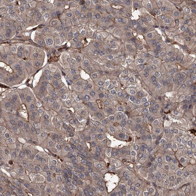 GRIP1 Antibody in Immunohistochemistry (Paraffin) (IHC (P))