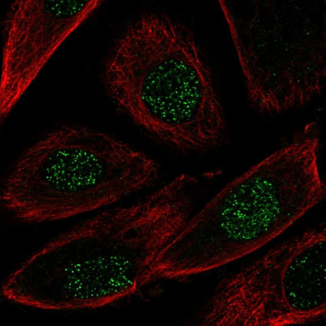 NRG2 Antibody in Immunocytochemistry (ICC/IF)