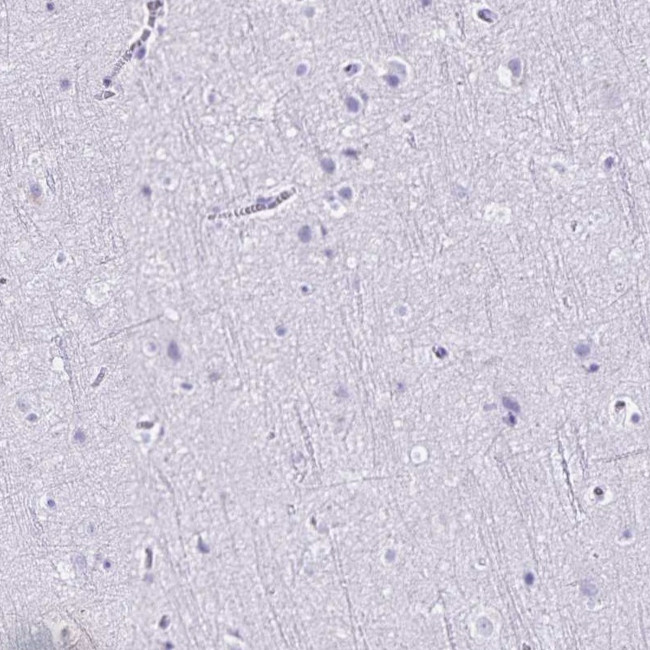CD27 Antibody in Immunohistochemistry (Paraffin) (IHC (P))